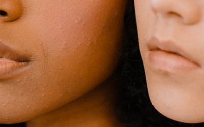 Ghid de Ingrijire pentru TEN GRAS Ghid de Ingrijire pentru TEN GRAS